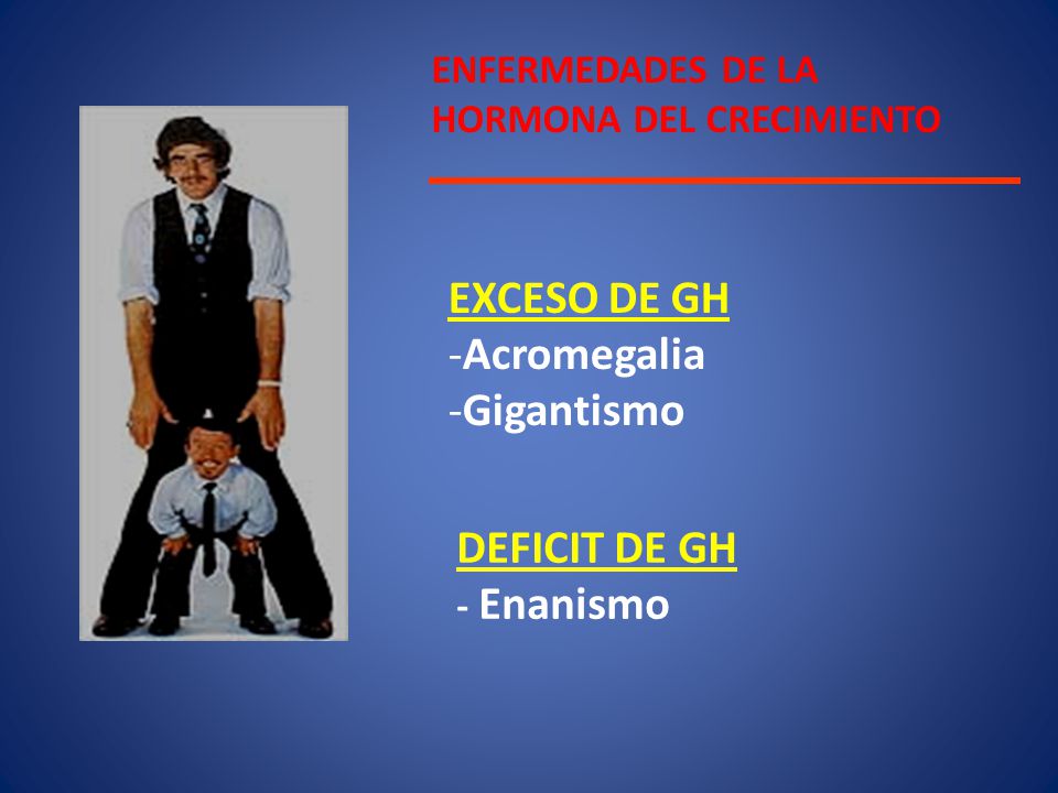 EXCESO DE GH Acromegalia Gigantismo DEFICIT DE GH ENFERMEDADES DE LA