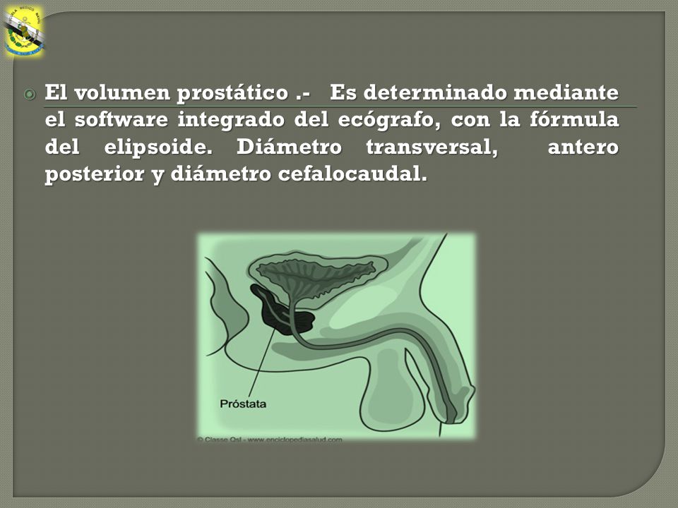 El volumen prostático .- Es determinado mediante el software integrado del ecógrafo, con la fórmula del elipsoide.
