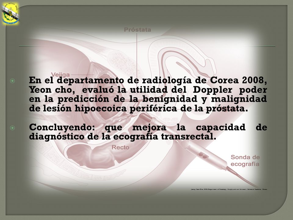 En el departamento de radiología de Corea 2008, Yeon cho, evaluó la utilidad del Doppler poder en la predicción de la benignidad y malignidad de lesión hipoecoica periférica de la próstata.