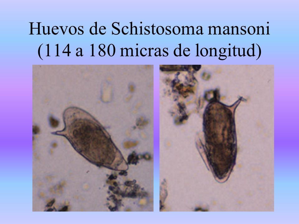 Huevos de Schistosoma mansoni (114 a 180 micras de longitud)