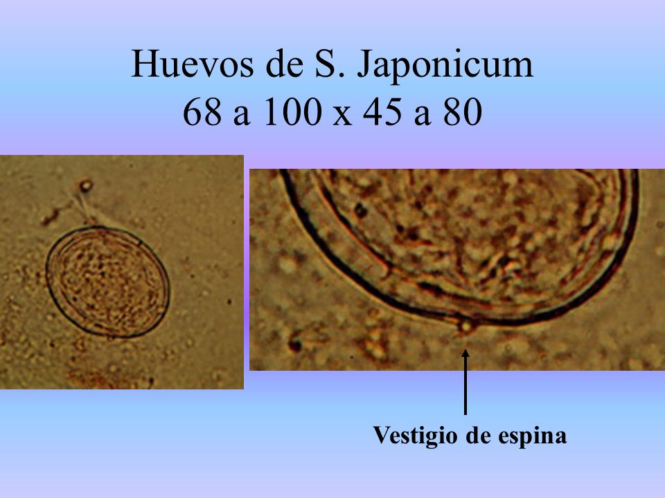 Huevos de S. Japonicum 68 a 100 x 45 a 80