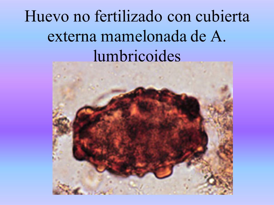 Huevo no fertilizado con cubierta externa mamelonada de A. lumbricoides