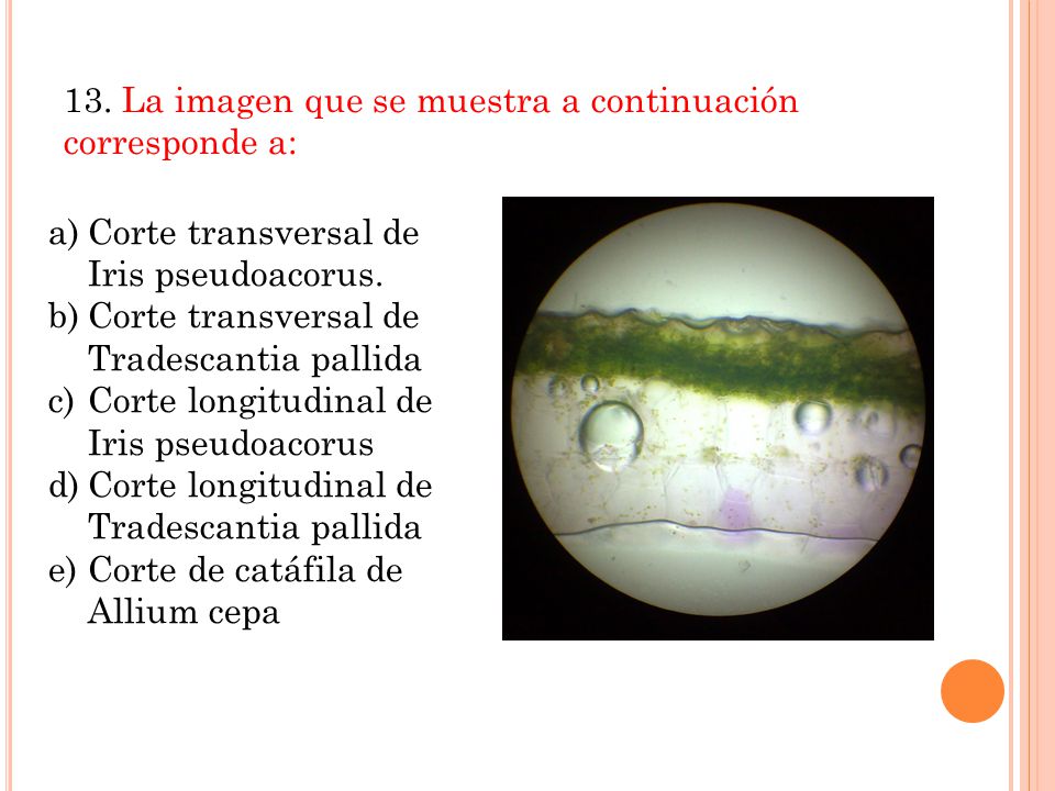 13. La imagen que se muestra a continuación corresponde a: