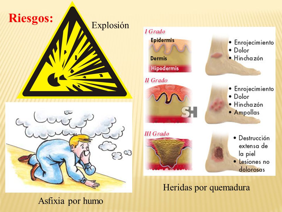 Riesgos: Explosión Heridas por quemadura Asfixia por humo