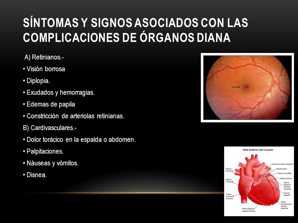 Síntomas y signos asociados con las complicaciones de órganos diana
