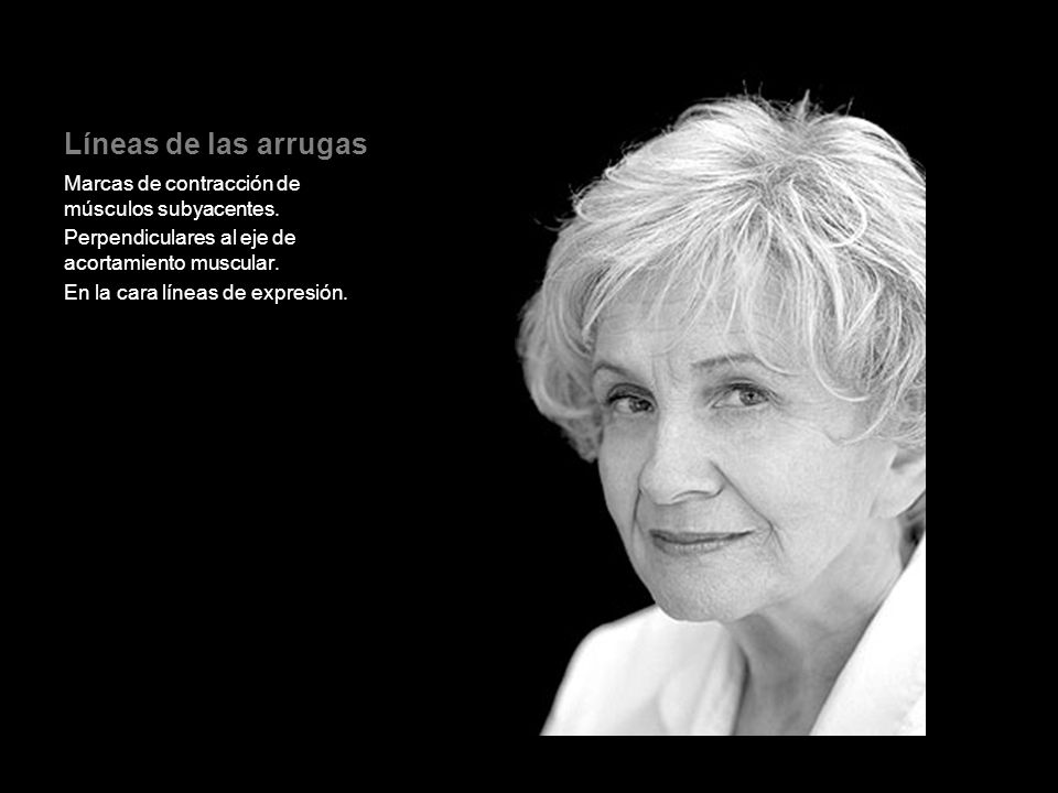 Líneas de las arrugas Marcas de contracción de músculos subyacentes.
