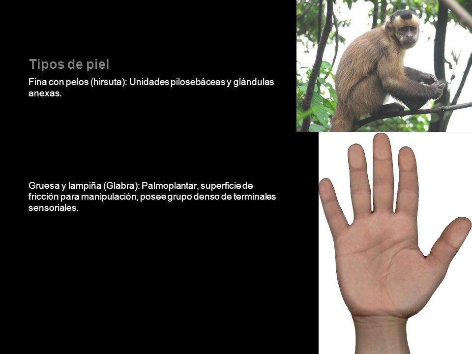 Tipos de piel Fina con pelos (hirsuta): Unidades pilosebáceas y glándulas anexas.