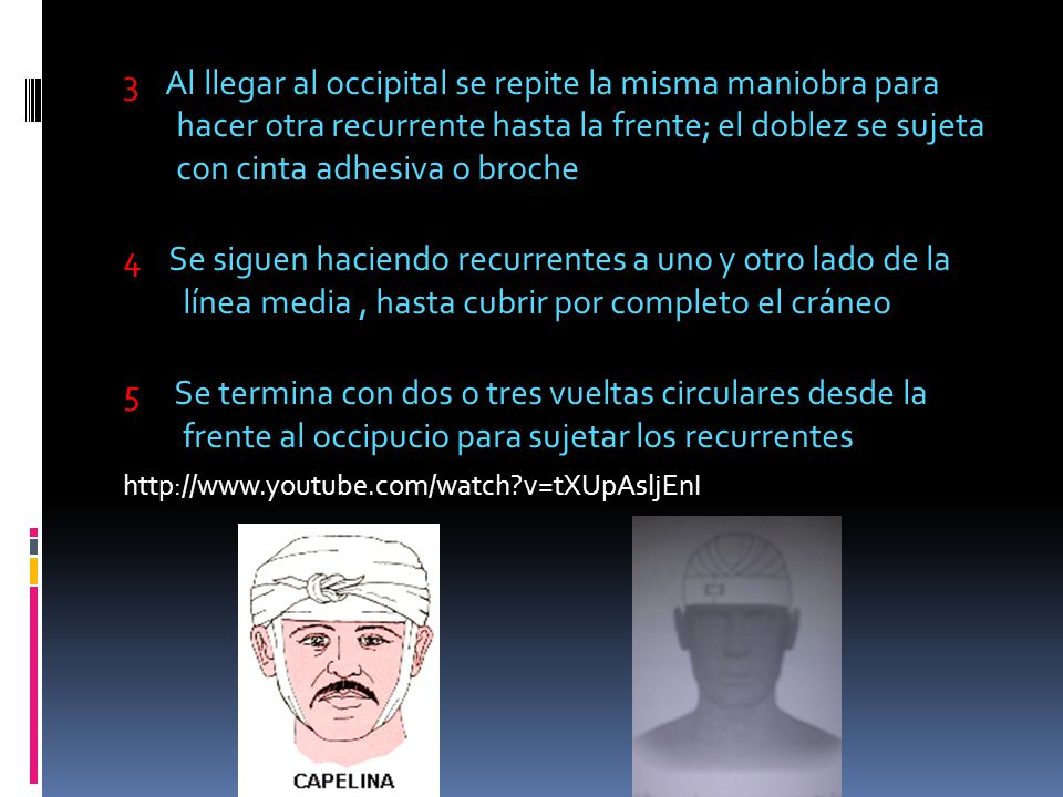 3 Al llegar al occipital se repite la misma maniobra para hacer otra recurrente hasta la frente; el doblez se sujeta con cinta adhesiva o broche
