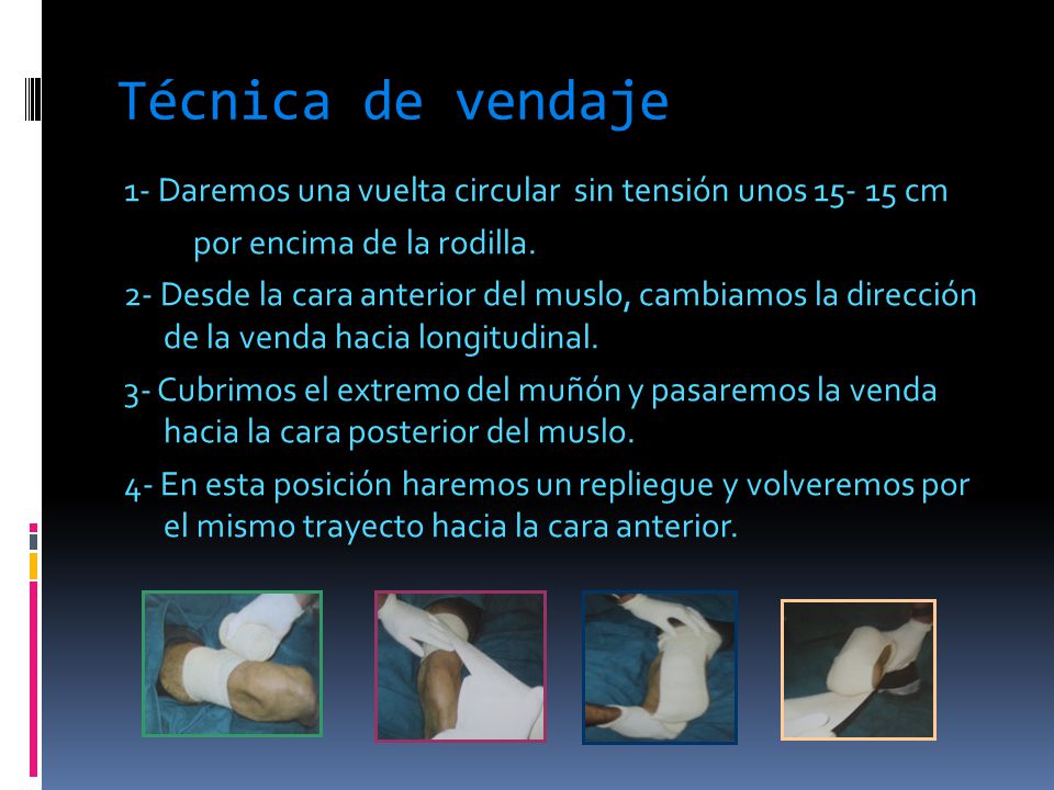 Técnica de vendaje 1- Daremos una vuelta circular sin tensión unos cm. por encima de la rodilla.