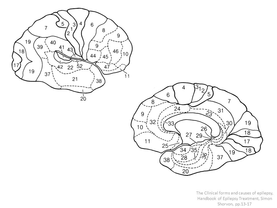 The Clinical forms and causes of epilepsy, Handbook of Epilepsy Treatment, Simon Shorvon, pp.13-17
