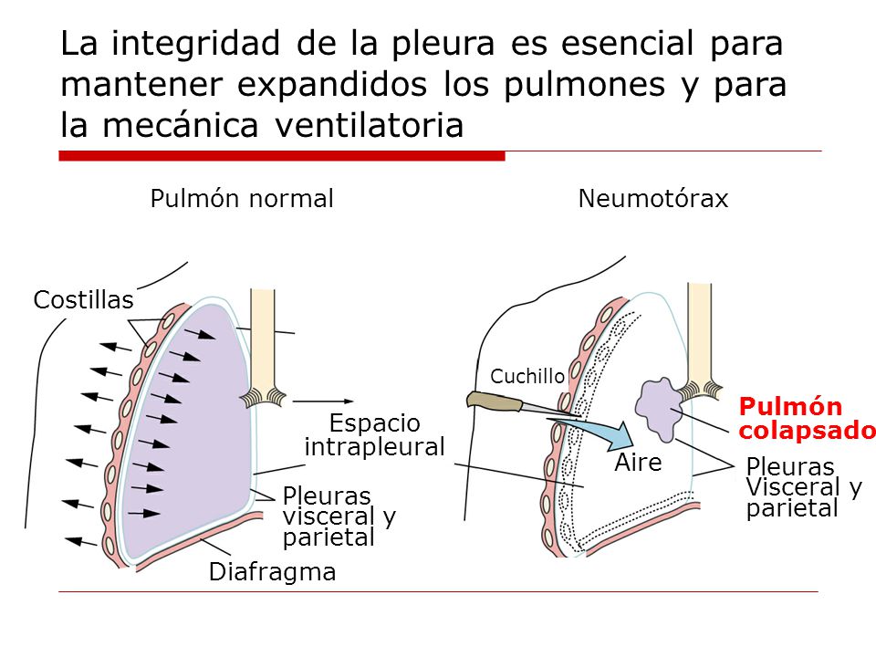 La integridad de la pleura es esencial para mantener expandidos los pulmones y para la mecánica ventilatoria