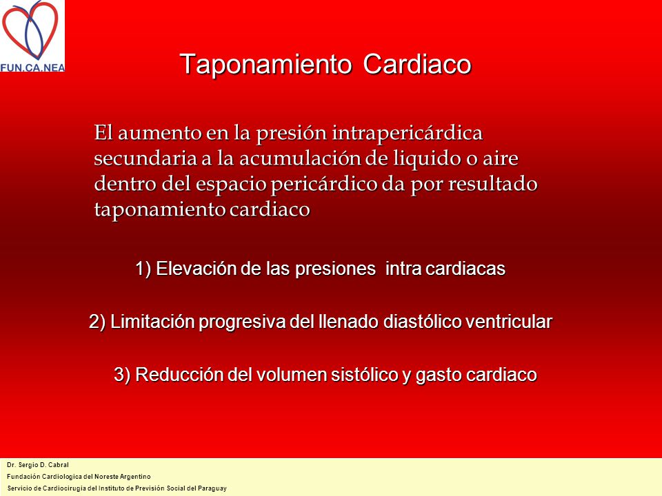 Taponamiento Cardiaco