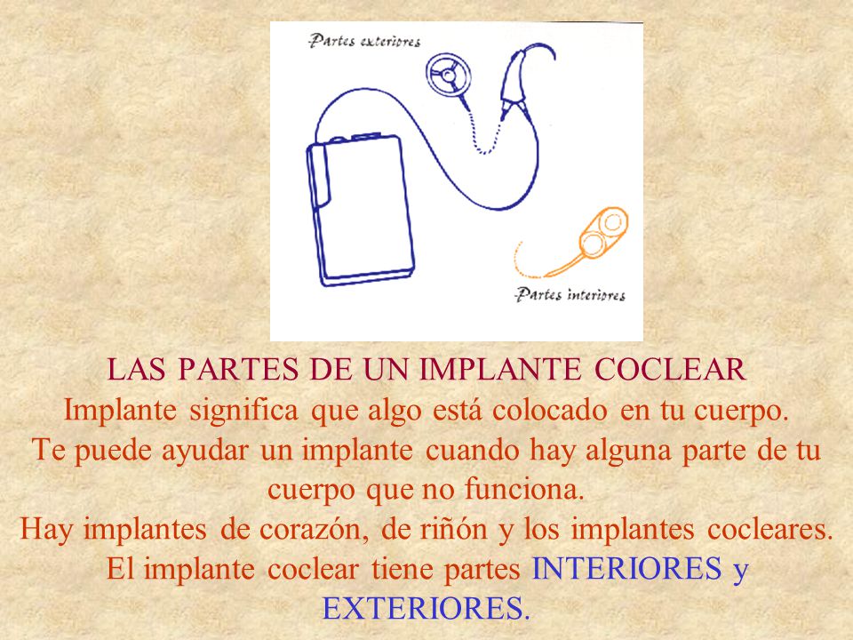 LAS PARTES DE UN IMPLANTE COCLEAR Implante significa que algo está colocado en tu cuerpo.