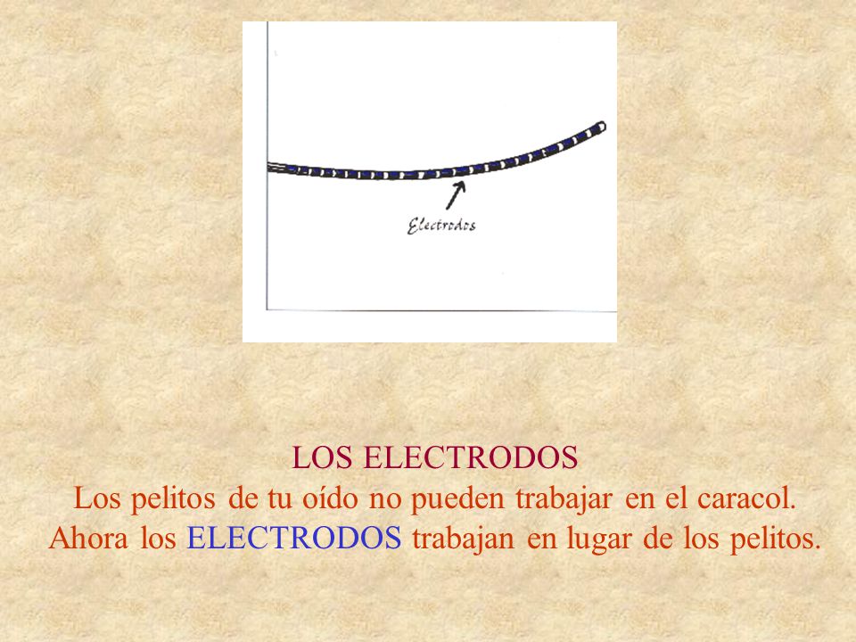 LOS ELECTRODOS Los pelitos de tu oído no pueden trabajar en el caracol