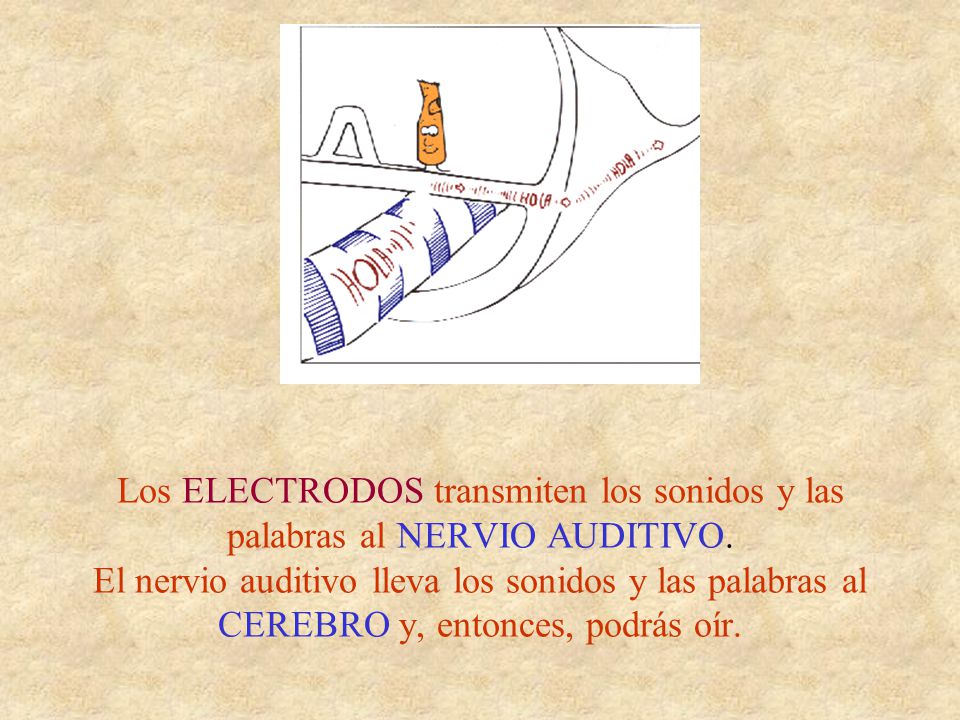 Los ELECTRODOS transmiten los sonidos y las palabras al NERVIO AUDITIVO.