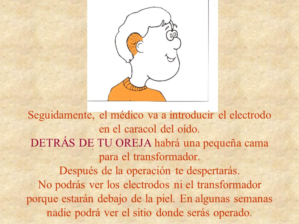 Seguidamente, el médico va a introducir el electrodo en el caracol del oído.