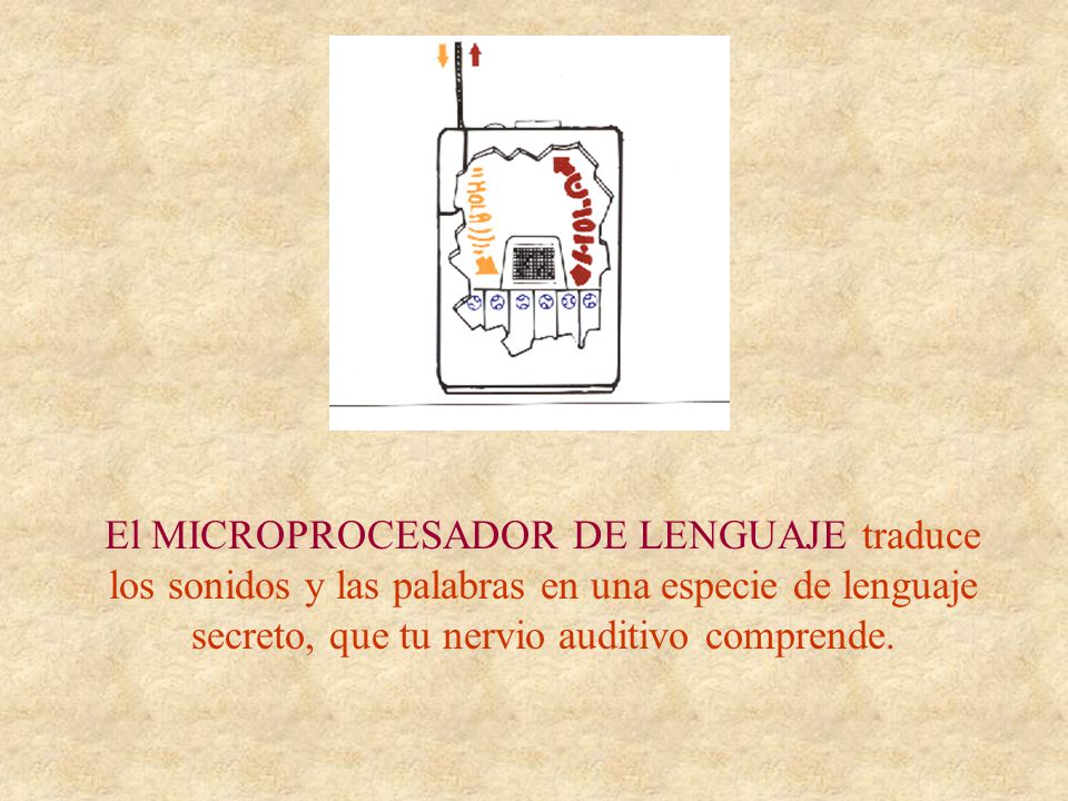 El MICROPROCESADOR DE LENGUAJE traduce los sonidos y las palabras en una especie de lenguaje secreto, que tu nervio auditivo comprende.