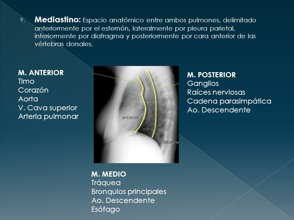 Mediastino: Espacio anatómico entre ambos pulmones, delimitado anteriormente por el esternón, lateralmente por pleura parietal, inferiormente por diafragma y posteriormente por cara anterior de las vértebras dorsales.