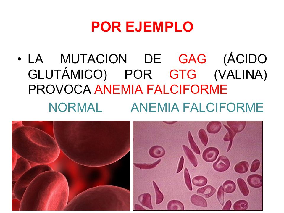 POR EJEMPLO LA MUTACION DE GAG (ÁCIDO GLUTÁMICO) POR GTG (VALINA) PROVOCA ANEMIA FALCIFORME.
