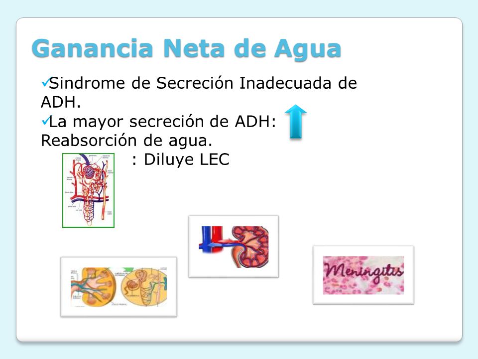 Ganancia Neta de Agua Sindrome de Secreción Inadecuada de ADH.
