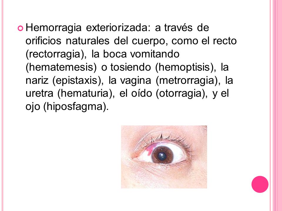 Hemorragia exteriorizada: a través de orificios naturales del cuerpo, como el recto (rectorragia), la boca vomitando (hematemesis) o tosiendo (hemoptisis), la nariz (epistaxis), la vagina (metrorragia), la uretra (hematuria), el oído (otorragia), y el ojo (hiposfagma).