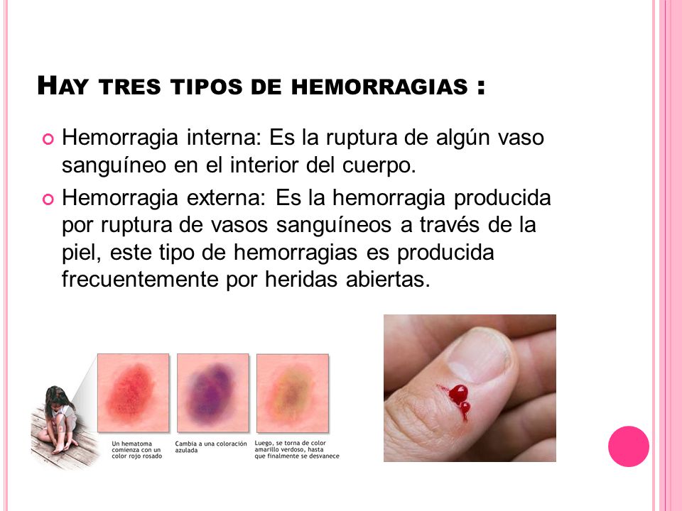 Hay tres tipos de hemorragias :