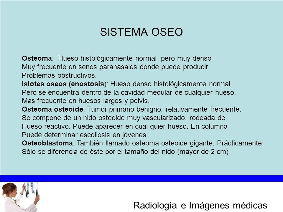 SISTEMA OSEO Osteoma: Hueso histológicamente normal pero muy denso