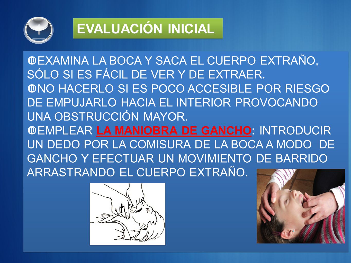 1 EVALUACIÓN INICIAL. EXAMINA LA BOCA Y SACA EL CUERPO EXTRAÑO, SÓLO SI ES FÁCIL DE VER Y DE EXTRAER.