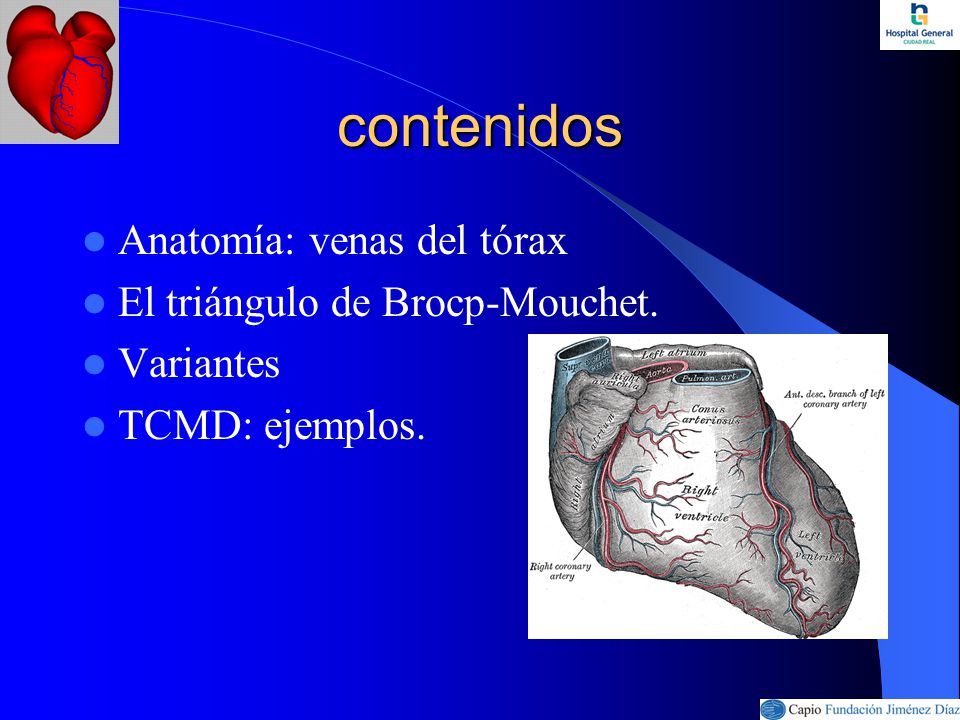 contenidos Anatomía: venas del tórax El triángulo de Brocp-Mouchet.