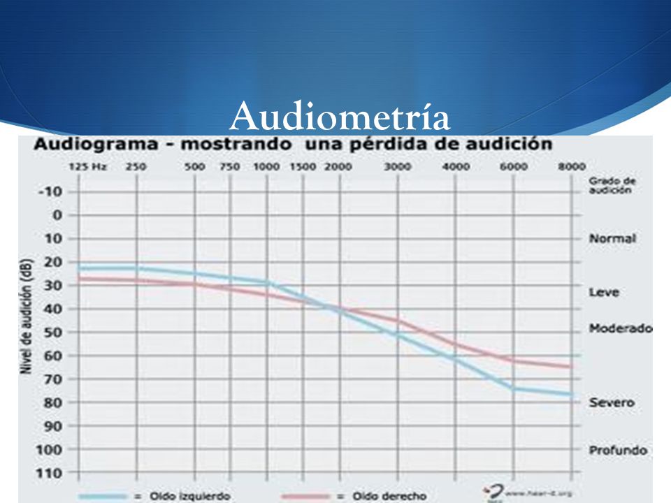 Audiometría Para la vía ósea se pone en contacto con la apófisis mastoides un vibrador conveniente.