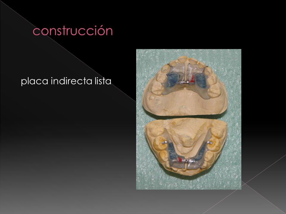 construcción placa indirecta lista