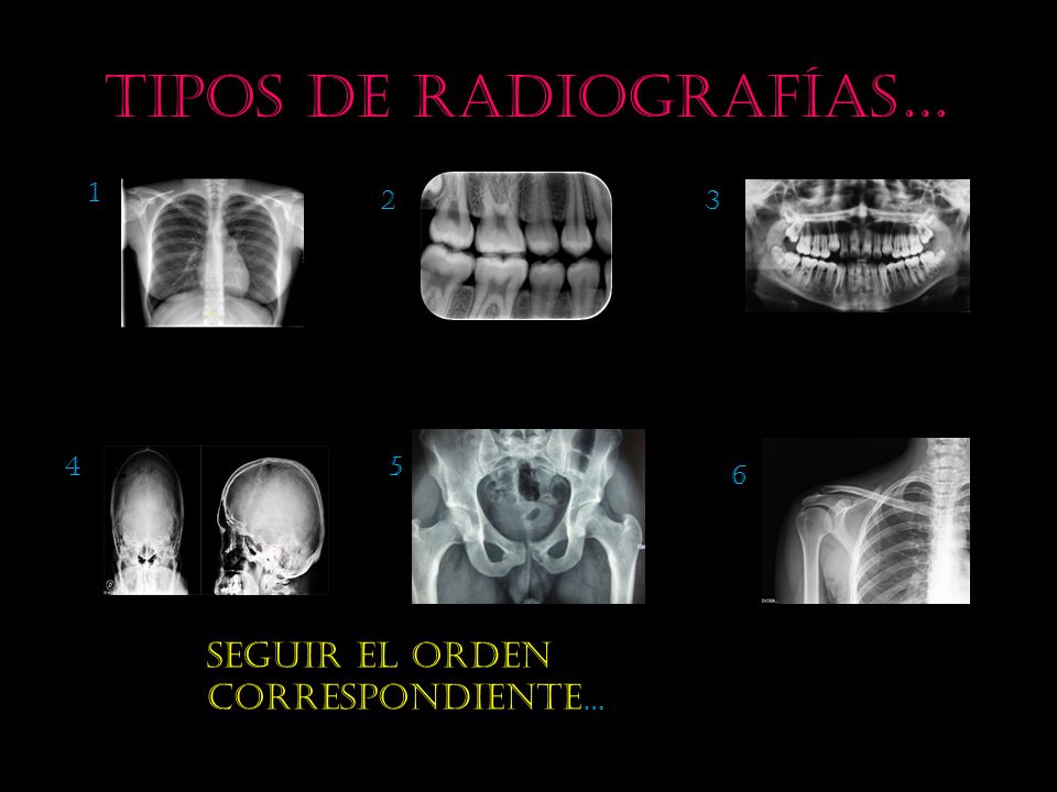 Tipos de radiografías…