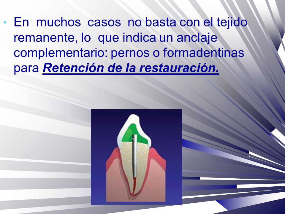 En muchos casos no basta con el tejido remanente, lo que indica un anclaje complementario: pernos o formadentinas para Retención de la restauración.
