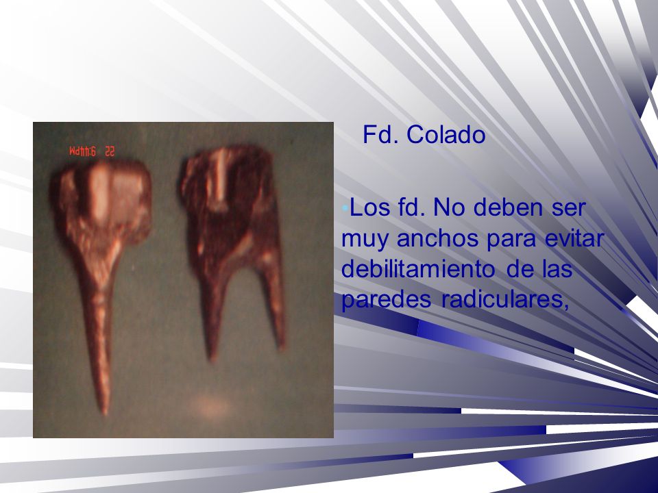 Fd. Colado Los fd. No deben ser muy anchos para evitar debilitamiento de las paredes radiculares,