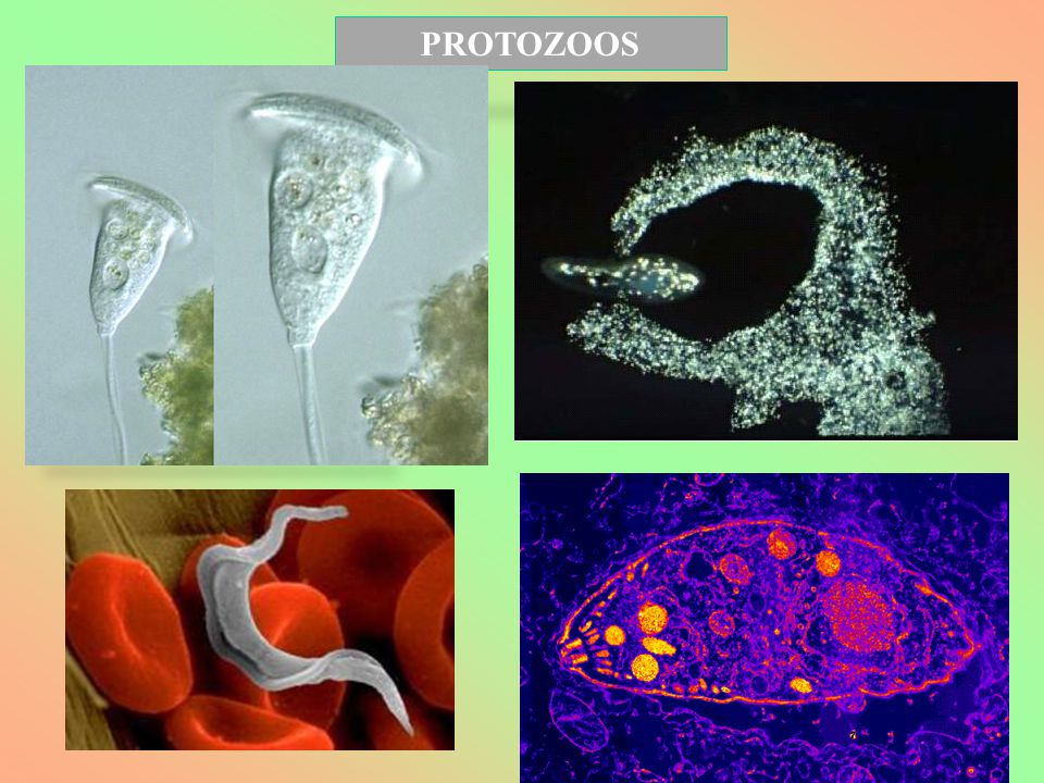 PROTOZOOS EUGLENA
