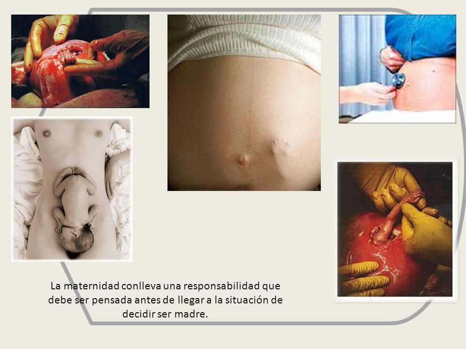 La maternidad conlleva una responsabilidad que debe ser pensada antes de llegar a la situación de decidir ser madre.