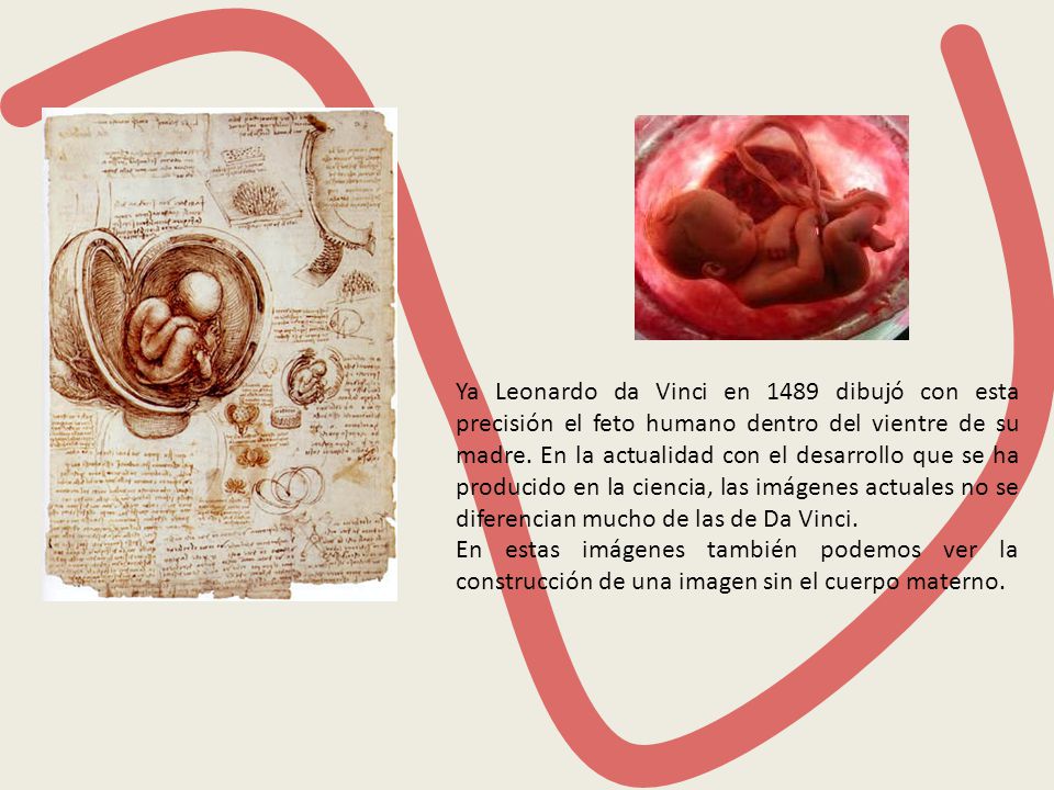 Ya Leonardo da Vinci en 1489 dibujó con esta precisión el feto humano dentro del vientre de su madre. En la actualidad con el desarrollo que se ha producido en la ciencia, las imágenes actuales no se diferencian mucho de las de Da Vinci.