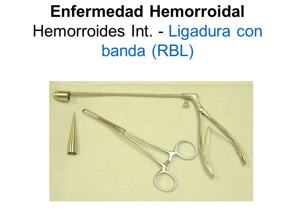Enfermedad Hemorroidal Hemorroides Int. - Ligadura con banda (RBL)