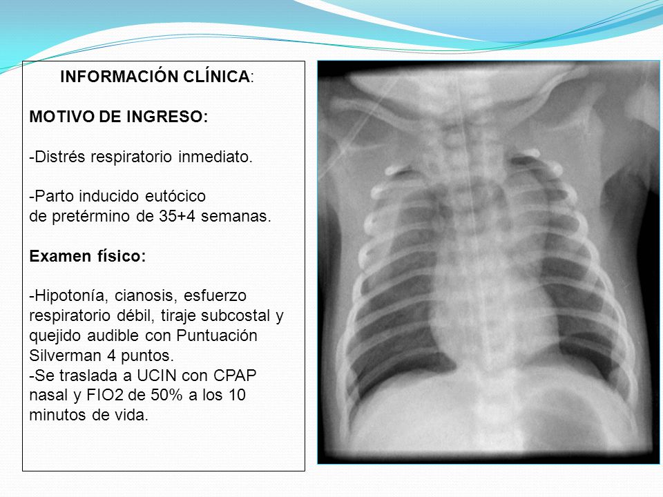 Información clínica: MOTIVO DE INGRESO: