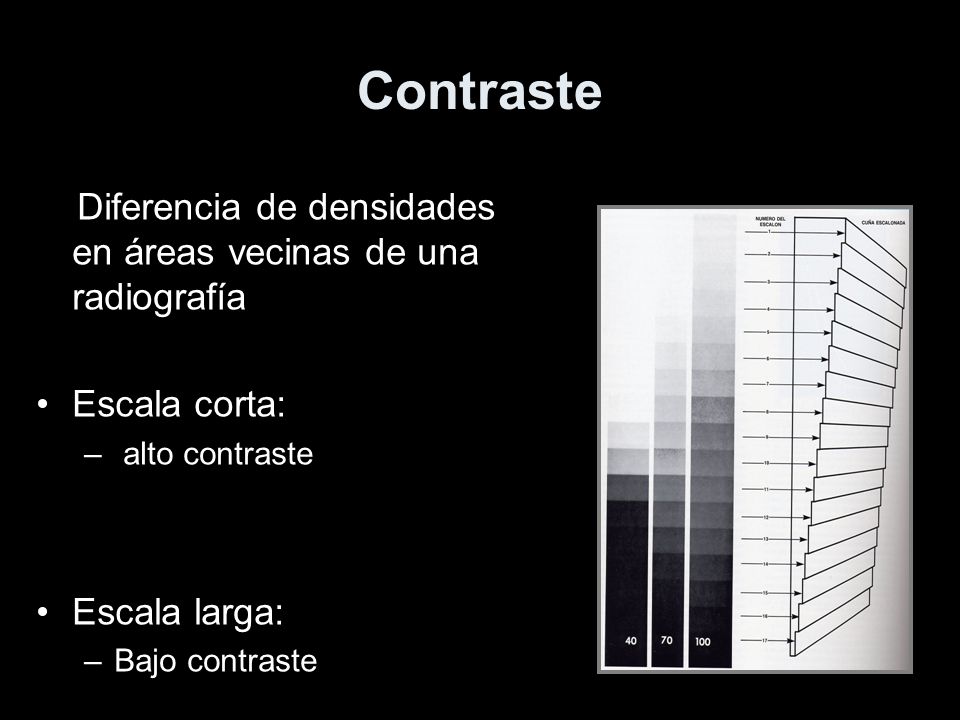 Contraste Diferencia de densidades en áreas vecinas de una radiografía