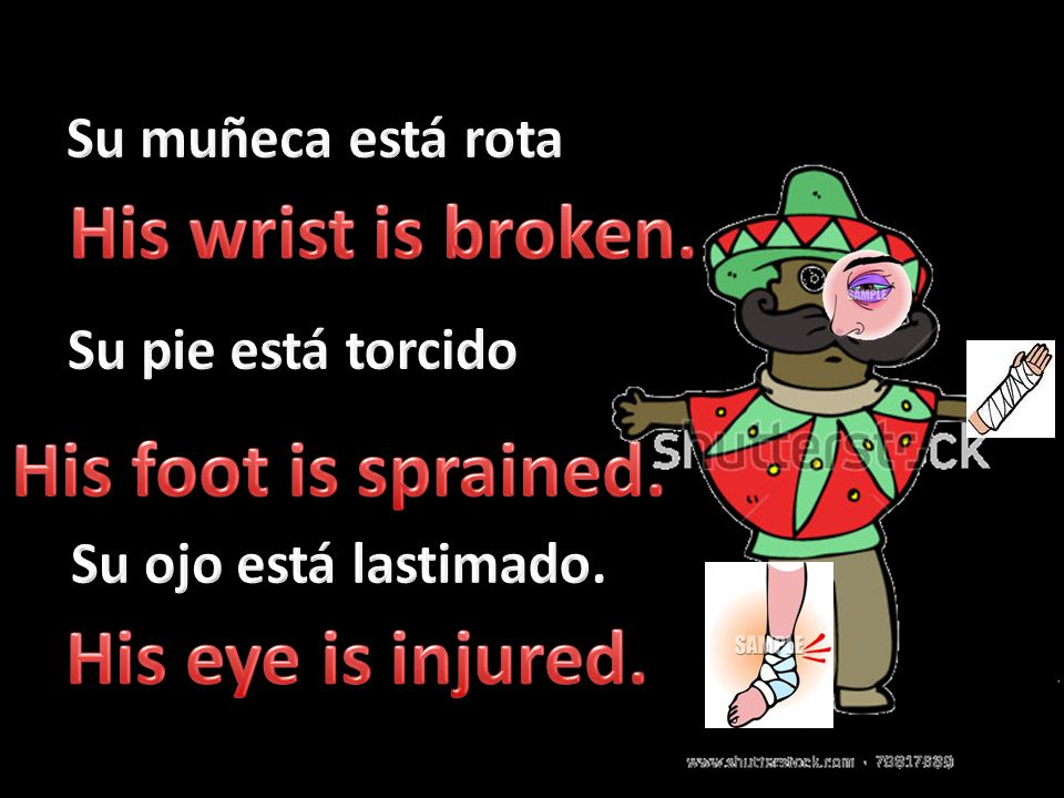 His wrist is broken. His foot is sprained. His eye is injured.