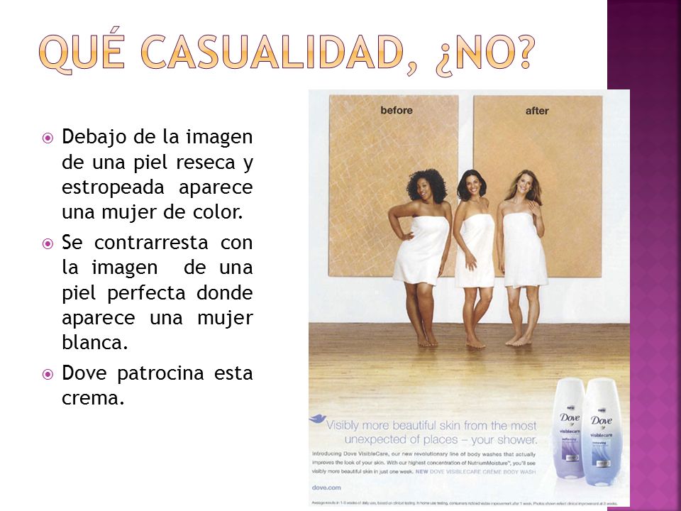 QUÉ CASUALIDAD, ¿NO Debajo de la imagen de una piel reseca y estropeada aparece una mujer de color.