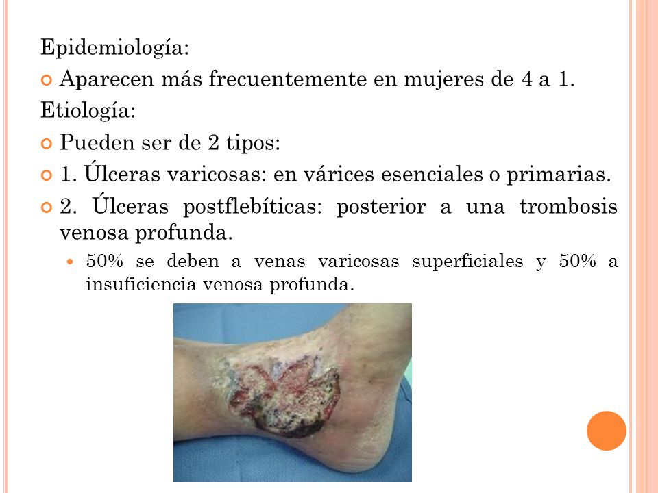 Aparecen más frecuentemente en mujeres de 4 a 1. Etiología: