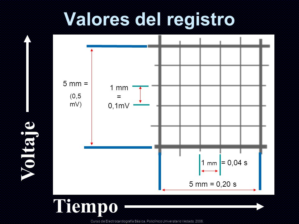 Voltaje Tiempo Valores del registro 5 mm = 1 mm = 0,1mV 1 mm = 0,04 s
