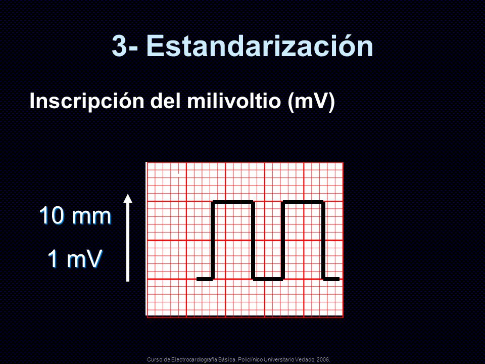 3- Estandarización 10 mm 1 mV Inscripción del milivoltio (mV)