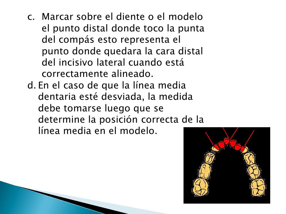 Marcar sobre el diente o el modelo el punto distal donde toco la punta del compás esto representa el punto donde quedara la cara distal del incisivo lateral cuando está correctamente alineado.