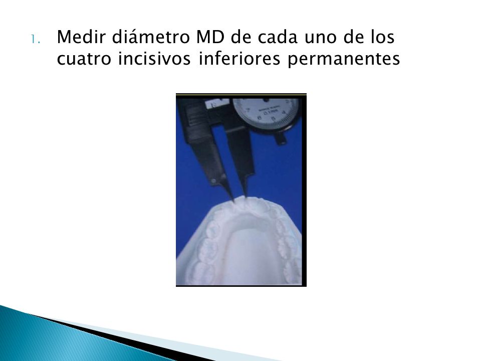 Medir diámetro MD de cada uno de los cuatro incisivos inferiores permanentes
