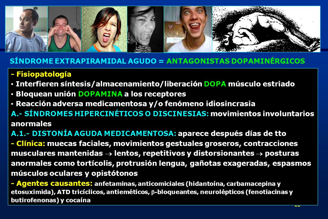 SÍNDROME EXTRAPIRAMIDAL AGUDO = ANTAGONISTAS DOPAMINÉRGICOS