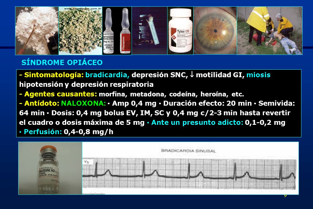 SÍNDROME OPIÁCEO - Sintomatología: bradicardia, depresión SNC,  motilidad GI, miosis. hipotensión y depresión respiratoria.