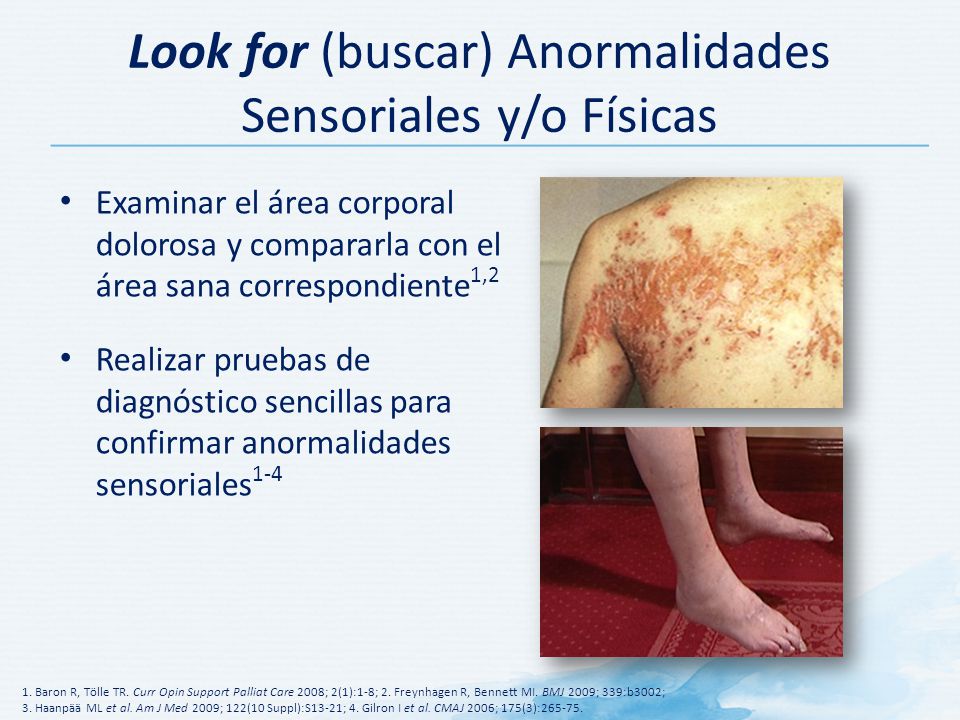 Look for (buscar) Anormalidades Sensoriales y/o Físicas